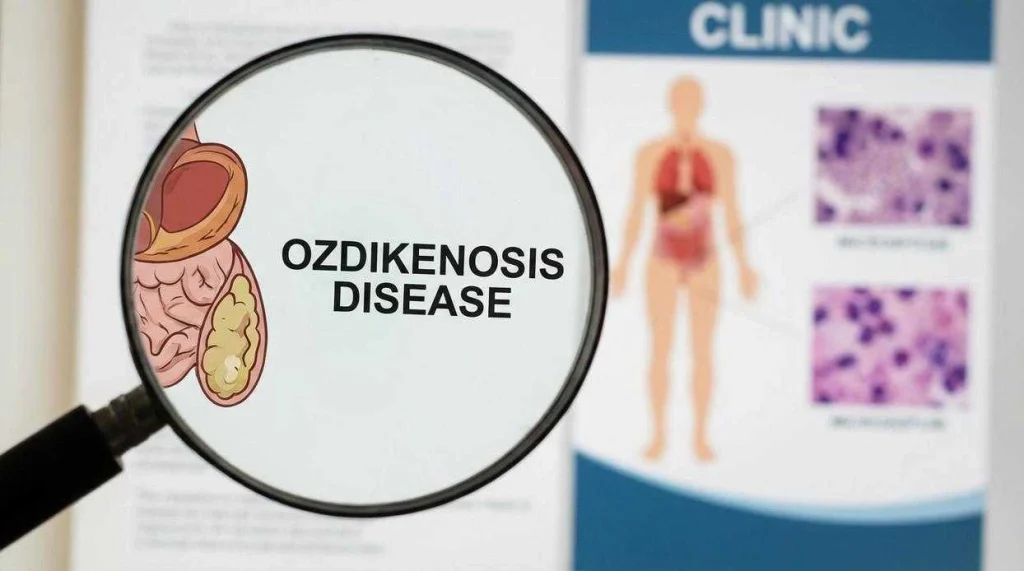 Magnifying glass showing "Ozdikenosis Disease" text with organ illustration